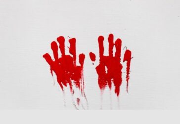 mani sangue