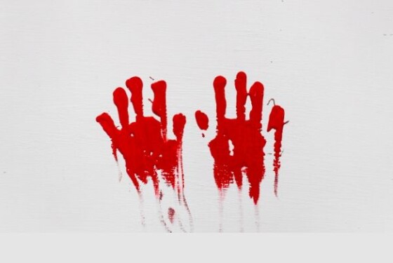 mani sangue