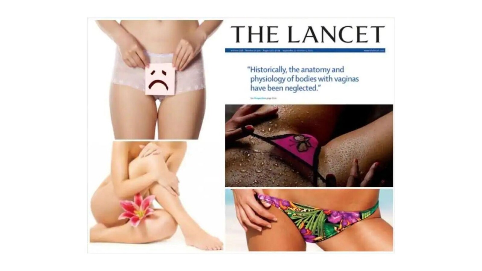 the lancet